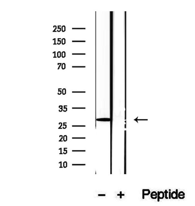 DIO1 Antibody in Western Blot (WB)