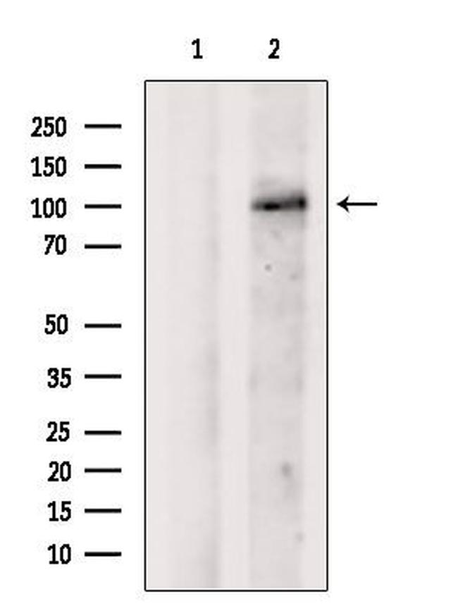 DIS3 Antibody in Western Blot (WB)