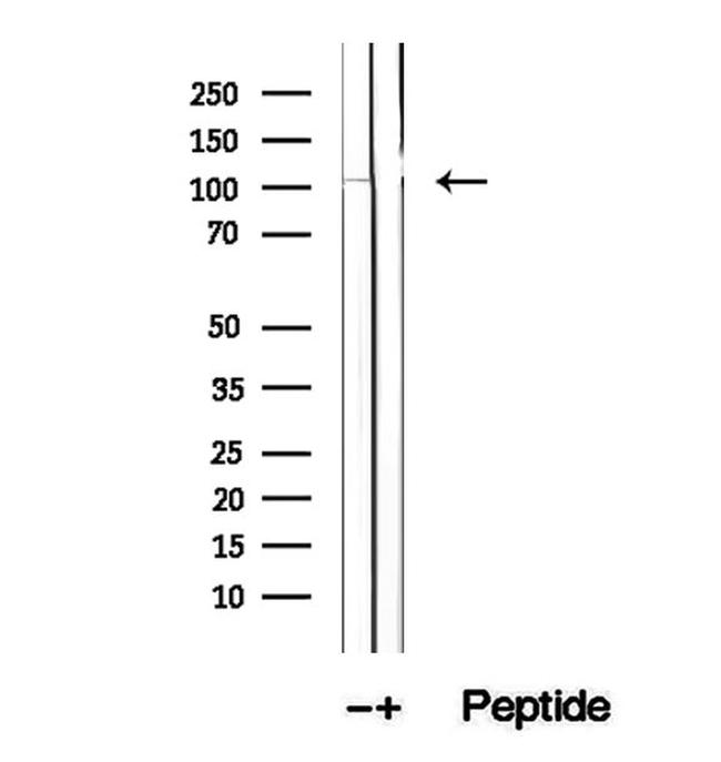 DIS3 Antibody in Western Blot (WB)