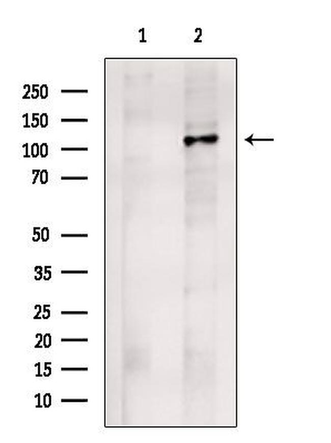 Drebrin Antibody in Western Blot (WB)