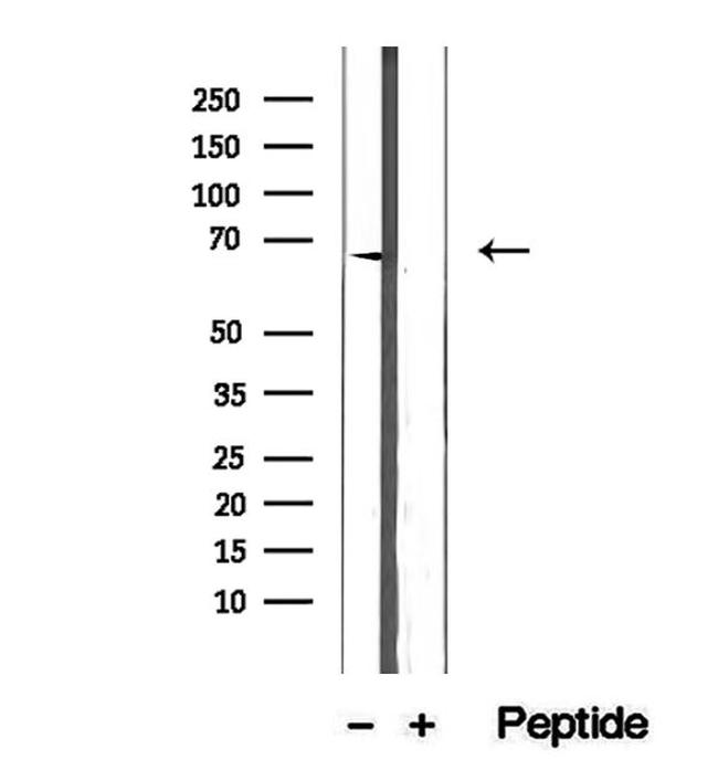 ETFDH Antibody in Western Blot (WB)