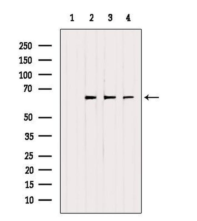 ETFDH Antibody in Western Blot (WB)