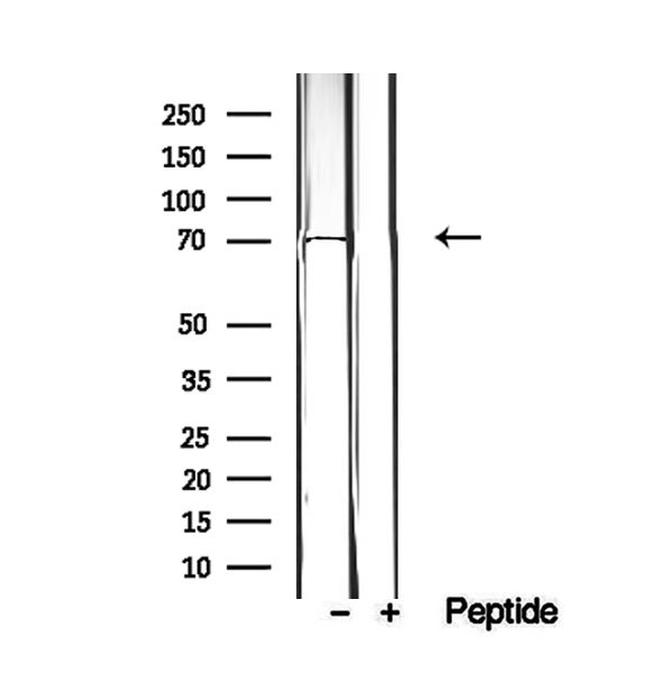 EXOC5 Antibody in Western Blot (WB)