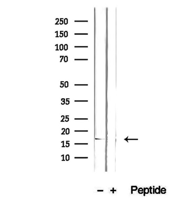 GMFG Antibody in Western Blot (WB)