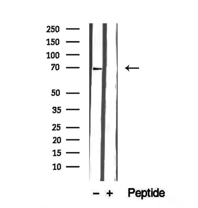 GPD2 Antibody in Western Blot (WB)