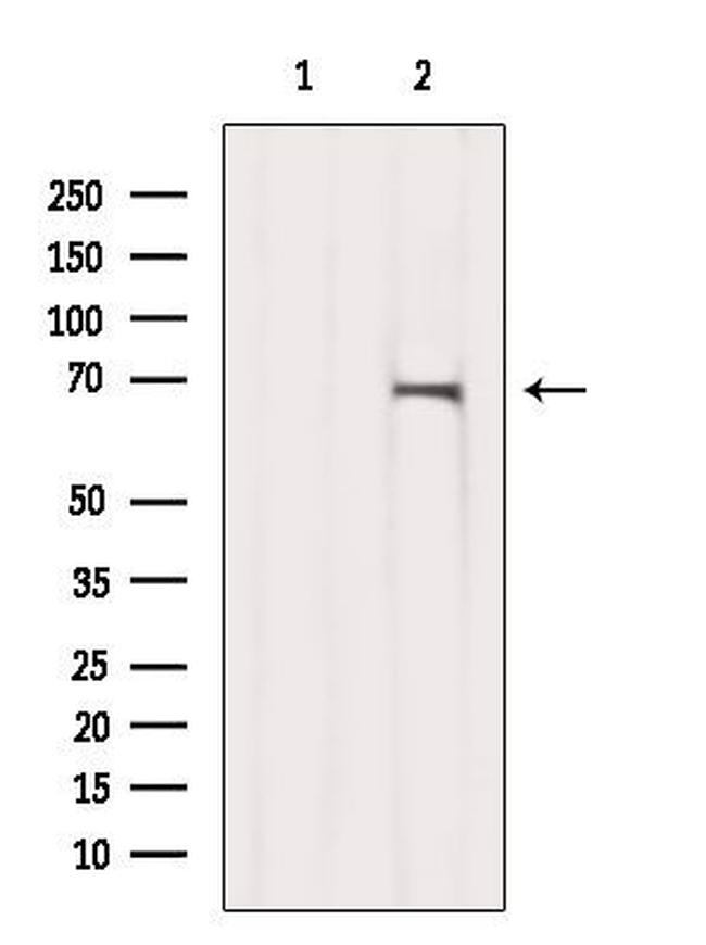 GPD2 Antibody in Western Blot (WB)