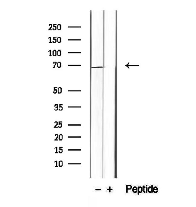 INSIG1 Antibody in Western Blot (WB)