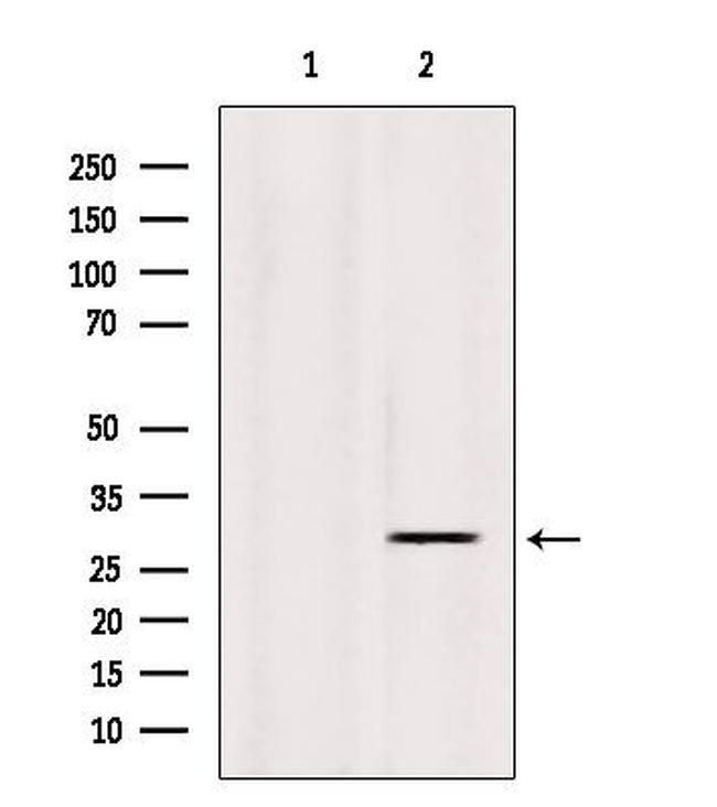 INSIG1 Antibody in Western Blot (WB)