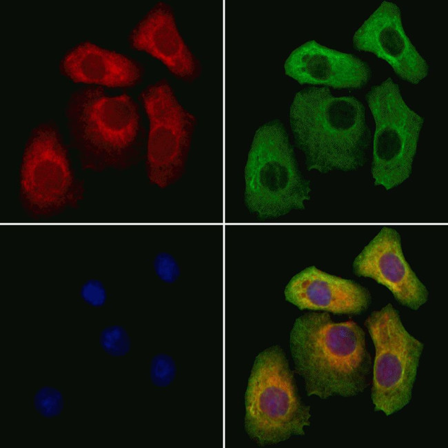 KIDINS220 Antibody in Immunocytochemistry (ICC/IF)