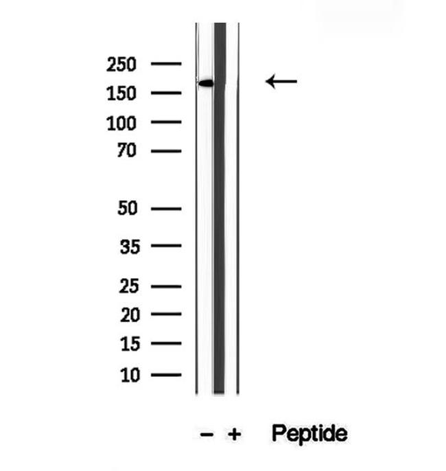 KIDINS220 Antibody in Western Blot (WB)