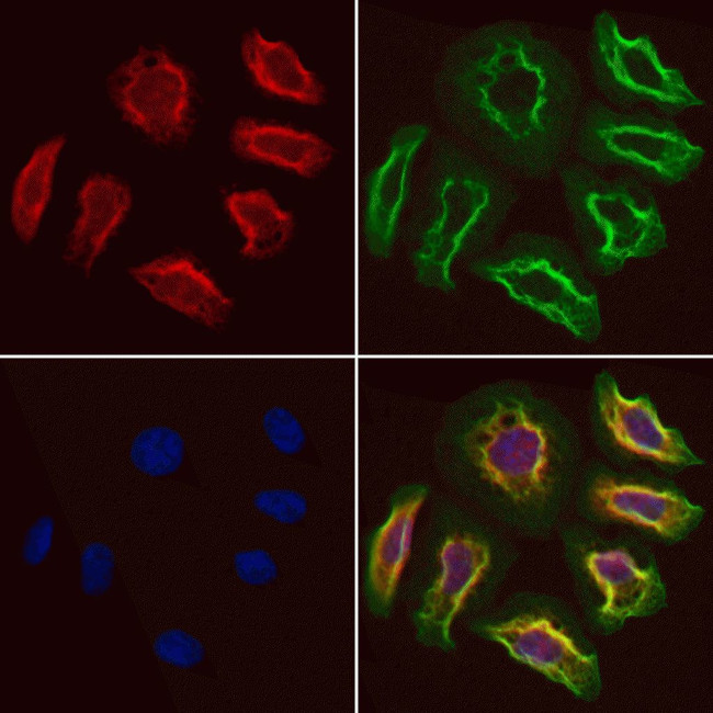 LAPTM4B Antibody in Immunocytochemistry (ICC/IF)