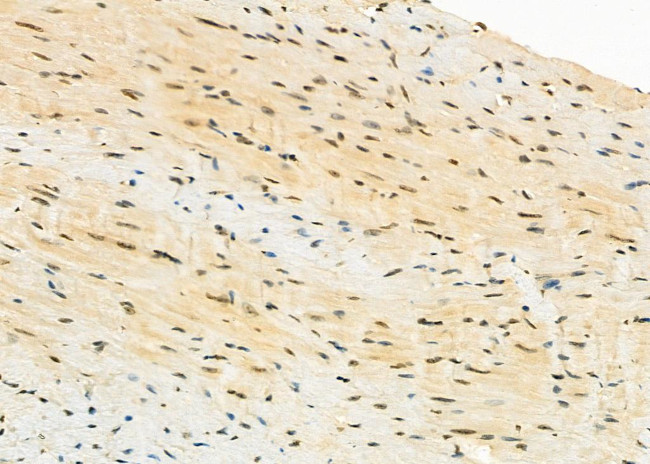 LRP130 Antibody in Immunohistochemistry (Paraffin) (IHC (P))