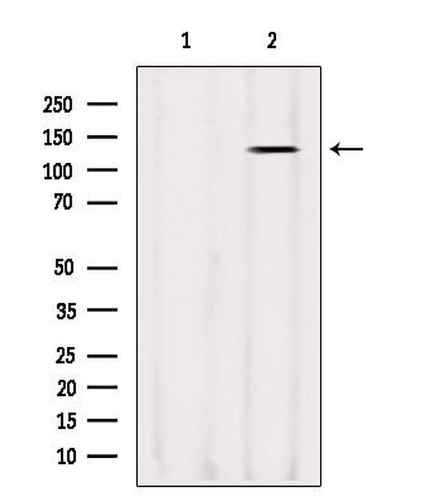 LRP130 Antibody in Western Blot (WB)