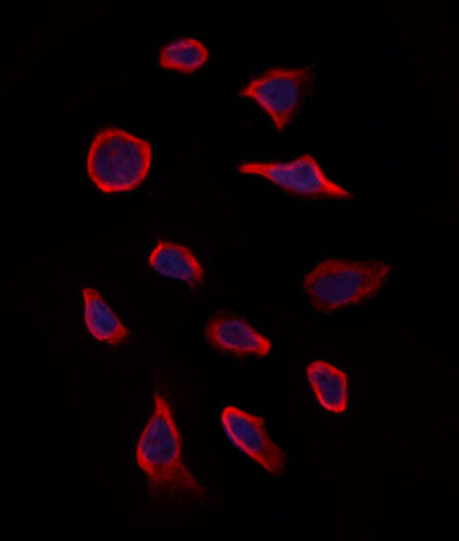 MMP28 Antibody in Immunocytochemistry (ICC/IF)