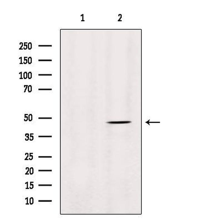 MMP28 Antibody in Western Blot (WB)