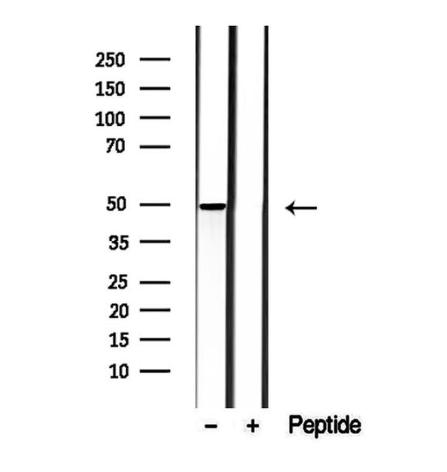 MMP28 Antibody in Western Blot (WB)