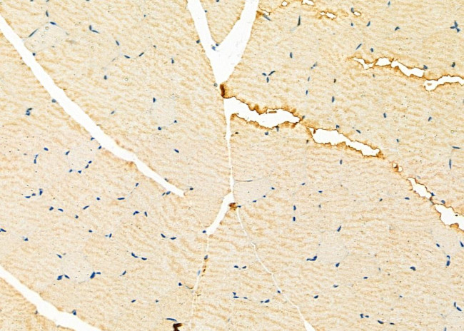 NCKAP1 Antibody in Immunohistochemistry (Paraffin) (IHC (P))