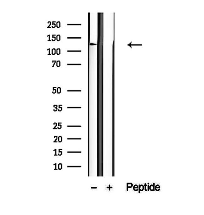 NCKAP1 Antibody in Western Blot (WB)