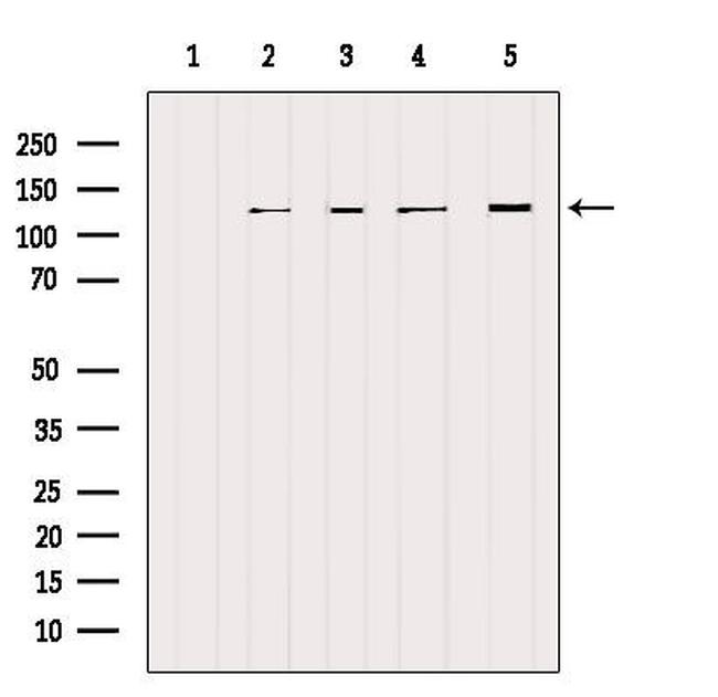 NCKAP1 Antibody in Western Blot (WB)