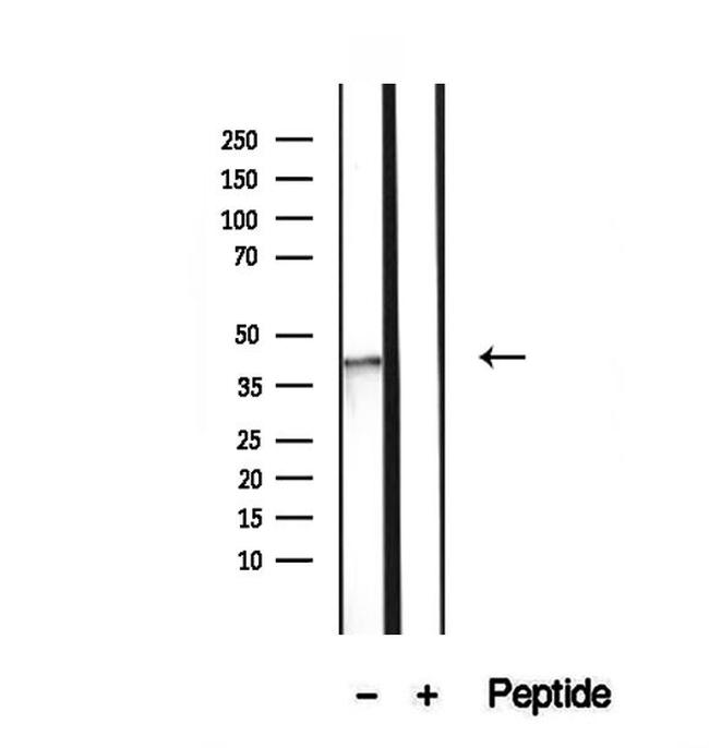 NSDHL Antibody in Western Blot (WB)