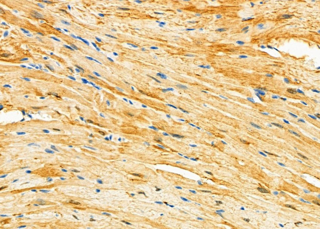 OPHN1 Antibody in Immunohistochemistry (Paraffin) (IHC (P))