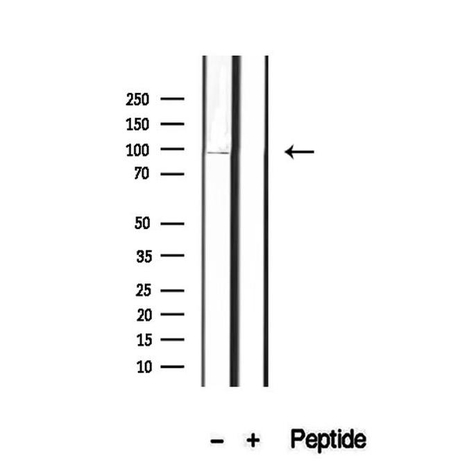 OPHN1 Antibody in Western Blot (WB)