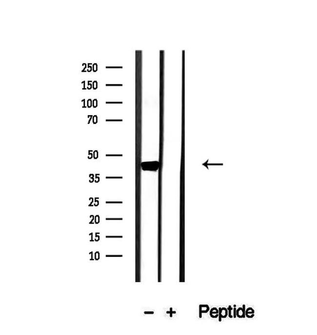 OXA1L Antibody in Western Blot (WB)