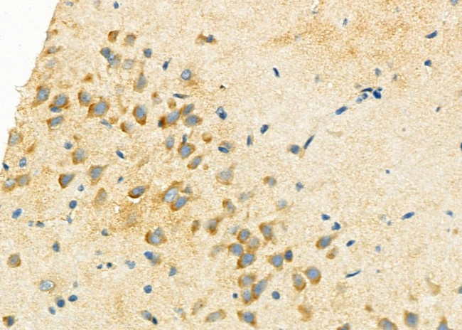 P4HA2 Antibody in Immunohistochemistry (Paraffin) (IHC (P))