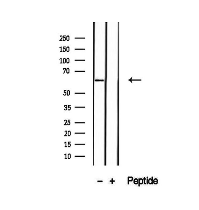 P4HA2 Antibody in Western Blot (WB)