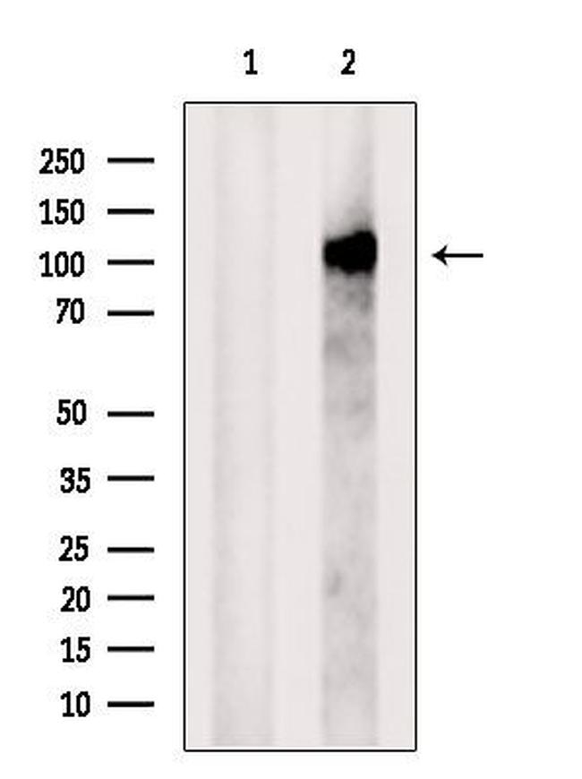 PACS2 Antibody in Western Blot (WB)