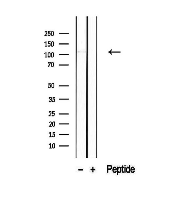 PACS2 Antibody in Western Blot (WB)