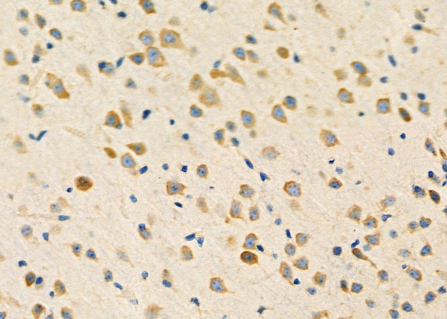 PHF19 Antibody in Immunohistochemistry (Paraffin) (IHC (P))