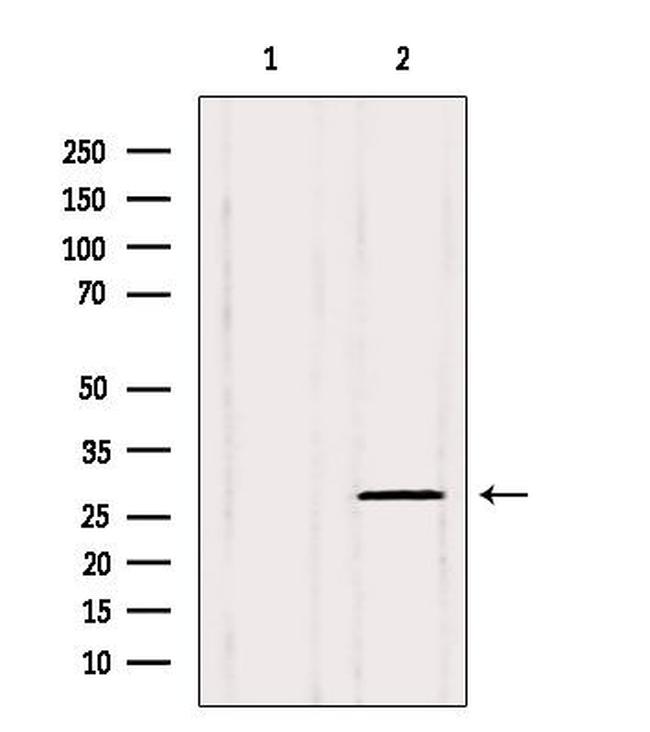 PHF19 Antibody in Western Blot (WB)