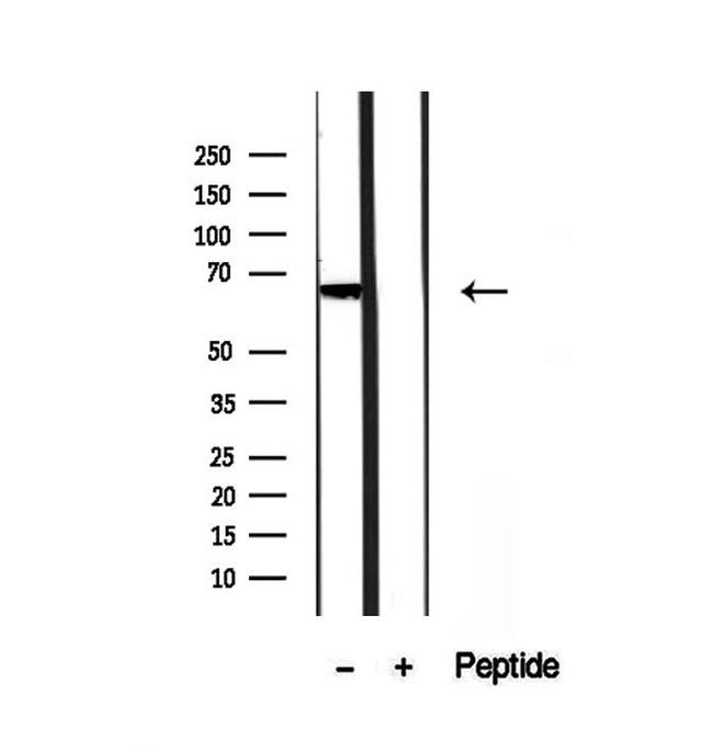 PHF19 Antibody in Western Blot (WB)