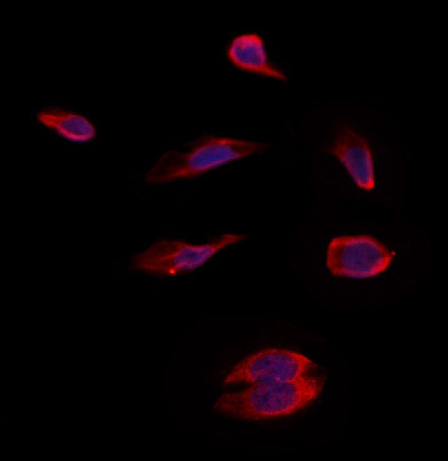 PMM2 Antibody in Immunocytochemistry (ICC/IF)