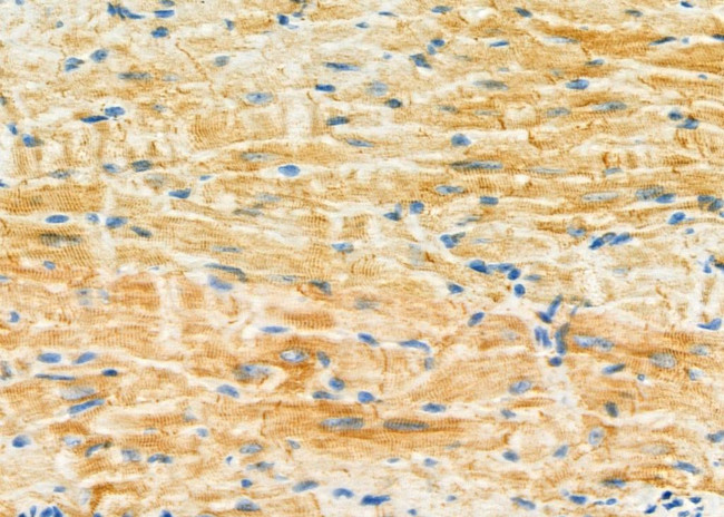 PMM2 Antibody in Immunohistochemistry (Paraffin) (IHC (P))