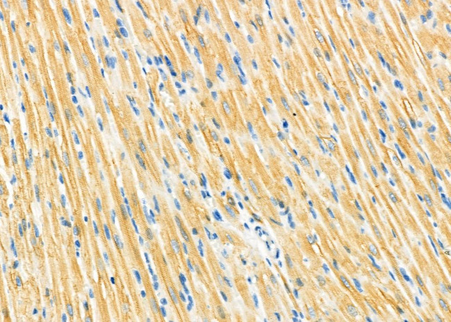 PMM2 Antibody in Immunohistochemistry (Paraffin) (IHC (P))