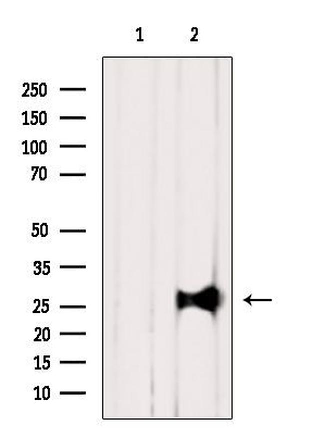 RAB12 Antibody in Western Blot (WB)