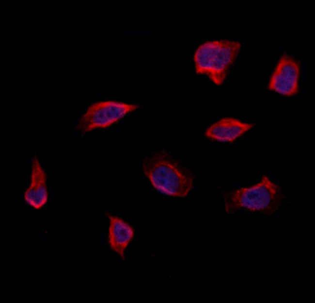 RAB14 Antibody in Immunocytochemistry (ICC/IF)