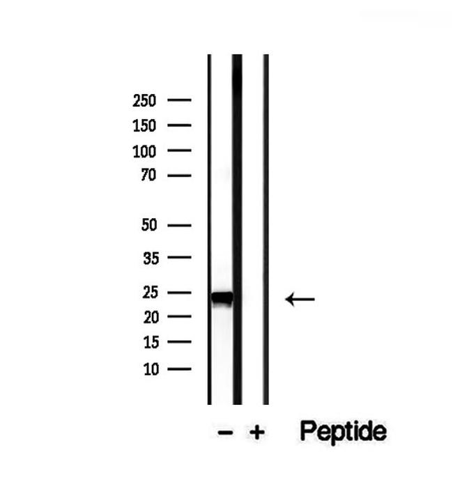 RAB14 Antibody in Western Blot (WB)