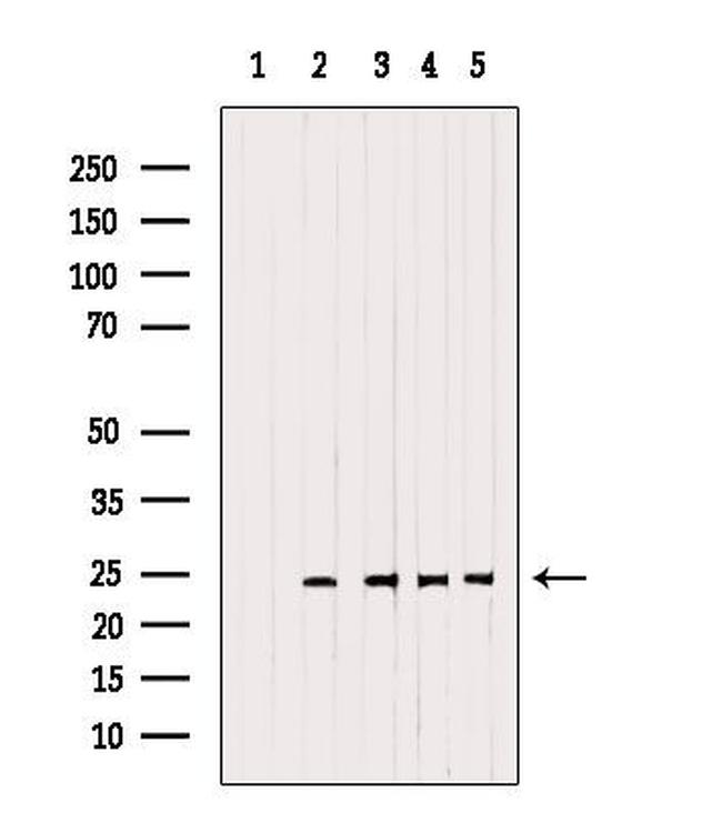 RAB14 Antibody in Western Blot (WB)