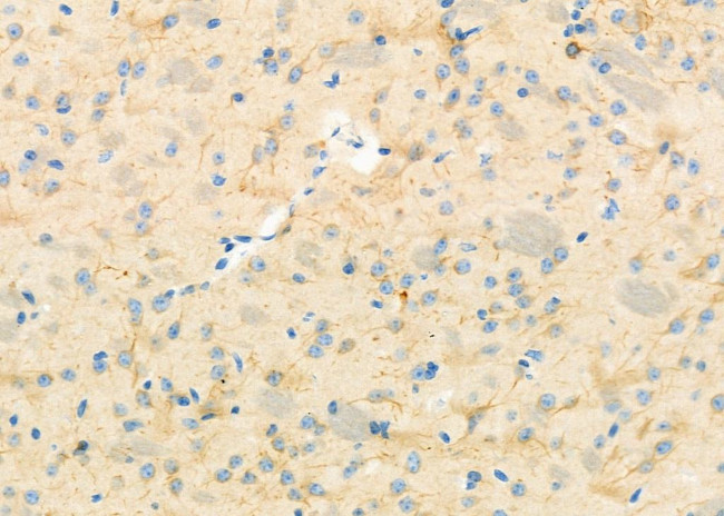 RBBP9 Antibody in Immunohistochemistry (Paraffin) (IHC (P))