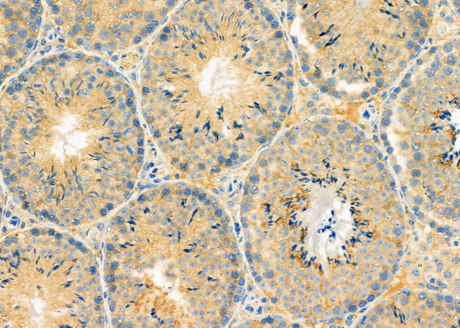 RBBP9 Antibody in Immunohistochemistry (Paraffin) (IHC (P))