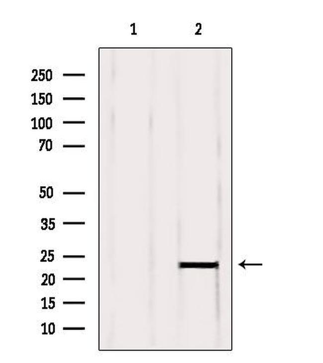 RBBP9 Antibody in Western Blot (WB)