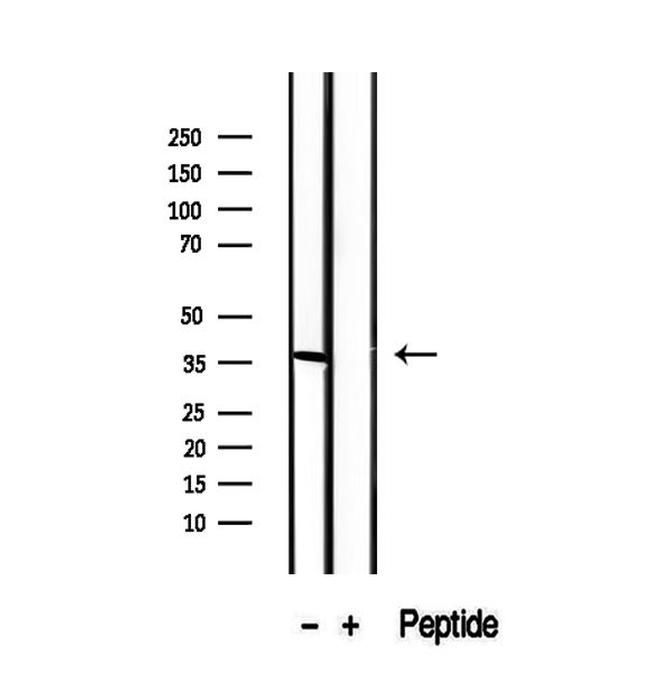 CRALBP Antibody in Western Blot (WB)