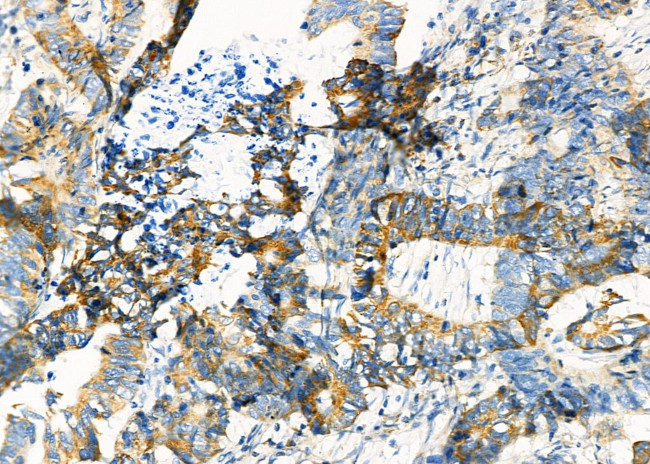 SHMT1 Antibody in Immunohistochemistry (Paraffin) (IHC (P))