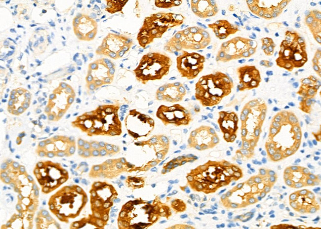 SHMT1 Antibody in Immunohistochemistry (Paraffin) (IHC (P))