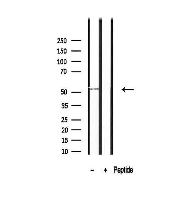 SHMT1 Antibody in Western Blot (WB)