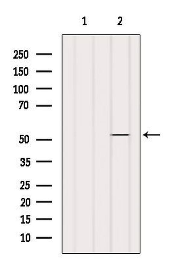 SHMT1 Antibody in Western Blot (WB)