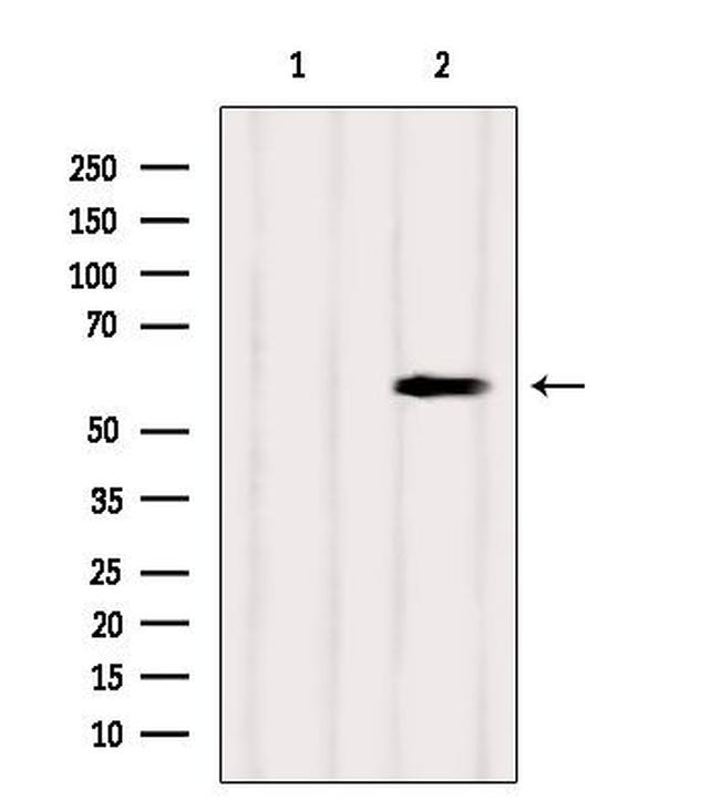 SUOX Antibody in Western Blot (WB)